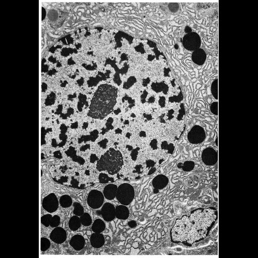  NCBI Organism:Rhipicephalus appendiculatus; Cell Types:acinar cell of salivary gland Cell Components:nucleus, nuclear envelope, nucleolus, endoplasmic reticulum, , nuclear chromatin; Biological process:nucleus organization, organelle organization, nucleolus organization, chromatin organization;