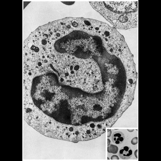  NCBI Organism:Homo sapiens; Cell Types:neutrophil Cell Components:nucleus, nuclear envelope, heterochromatin; Biological process:adaptive immune response, nucleus organization, heterochromatin organization;