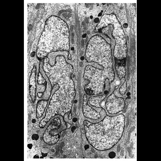  NCBI Organism:Chinchilla; Cell Types:epithelial cell Cell Components:nucleus, nuclear envelope, nuclear chromatin; Biological process:nucleus organization, chromatin organization;