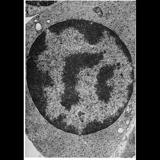  NCBI Organism:Cavia porcellus; Cell Types:plasma cell Cell Components:nucleus, chromatin, heterochromatin, nuclear envelope, ; Biological process:adaptive immune response, nucleus organization, immunoglobulin secretion involved in immune response, chromatin organization;