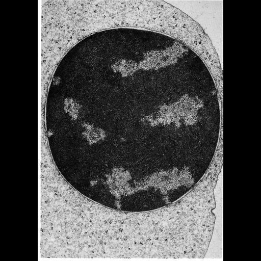  NCBI Organism:Cavia porcellus; Cell Types:erythroblast Cell Components:nucleus, heterochromatin, nuclear envelope, nuclear pore; Biological process:nucleus organization, chromatin organization;