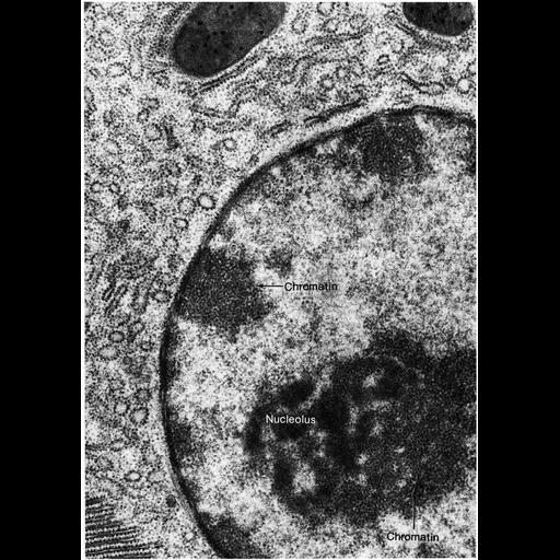  Cell Types:pancreatic acinar cell Cell Components:nucleus, heterochromatin, nucleolus, ribosome, rough endoplasmic reticulum, nuclear envelope; Biological process:nucleus organization, nucleolus organization, chromatin organization;