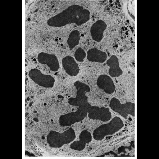  NCBI Organism:Batrachoseps attenuatus; Cell Types:myelocyte Cell Components:nuclear chromosome Biological process:nucleus organization, mitosis, mitotic prophase, chromatin organization;