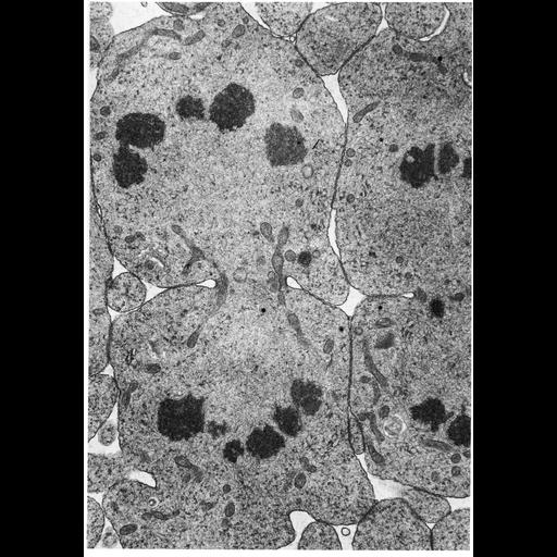  NCBI Organism:Insecta; Cell Types:spermatocyte Cell Components:nuclear chromosome, cleavage furrow; Biological process:mitosis, nucleus organization, mitotic anaphase, chromatin organization, chromosome organization, mitotic telophase, cytokinesis;