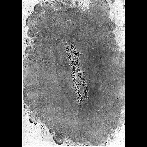  NCBI Organism:Homo sapiens; Cell Components:nuclear chromosome, chromatin, ; Biological process:nucleus organization, mitotic metaphase, chromatin organization, chromosome organization;