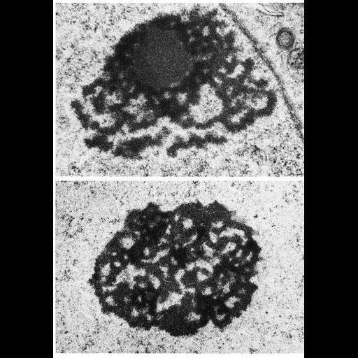  NCBI Organism:Didelphimorphia; Cell Types:spermatogonium Cell Components:nucleolus, nucleus, nuclear envelope, nuclear chromatin; Biological process:nucleus organization, RNA metabolic process, RNA metabolic process, nucleolus organization;