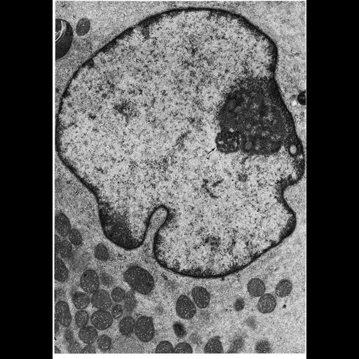  NCBI Organism:Sus scrofa scrofa; Cell Types:Leydig cell Cell Components:nucleus, chromatin, nucleolus, nuclear heterochromatin, nuclear envelope lumen, mitochondrion; Biological process:nucleus organization