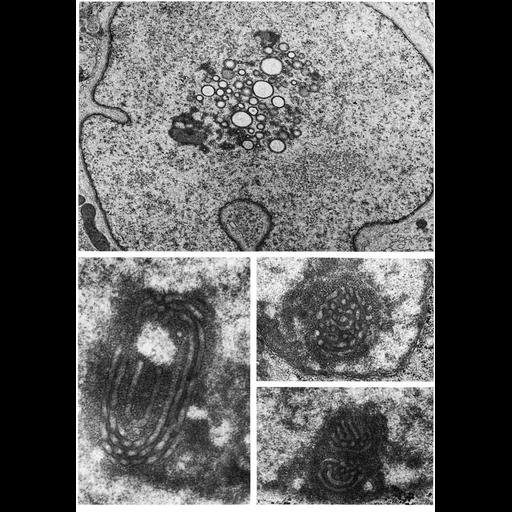  NCBI Organism:Barbus tauricus, Homo sapiens, ; Cell Types:Sertoli cell, glandular cell of endometrium; Cell Components:nucleolus, nucleus, nuclear envelope, nuclear chromatin; Biological process:nucleus organization, RNA metabolic process, nucleolus organization;