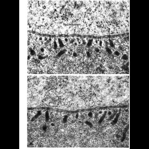  NCBI Organism:Anura; Cell Types:oocyte Cell Components:nuclear envelope, perinuclear region of cytoplasm, nuclear pore; Biological process:nucleus organization, nuclear transport, nuclear pore organization;