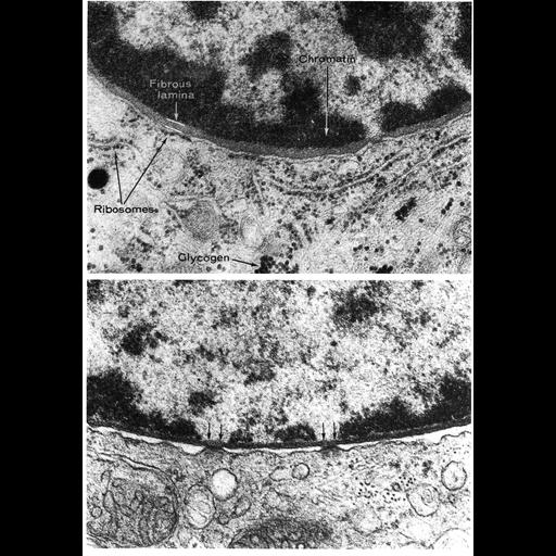  NCBI Organism:Homo sapiens, Rodentia, ; Cell Types:epidermal cell, Leydig cell; Cell Components:nuclear envelope, ribosome, glycogen granule, nuclear lamina, chromatin, rough endoplasmic reticulum, heterochromatin, glycogen granule; Biological process:nucleus organization, nuclear transport, chromatin organization;