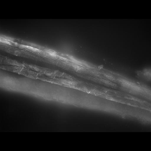  NCBI Organism:Caenorhabditis elegans; Cell Types:muscle cell Cell Components:actin filament Biological process:chronological cell aging