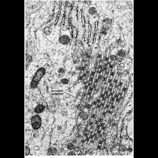  NCBI Organism:Homo sapiens; Cell Types:Sertoli cell Cell Components:annulate lamellae, nuclear pore; Biological process:nucleus organization