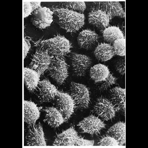  NCBI Organism:Homo sapiens; Cell Components:microvillus Biological process:cell projection organization