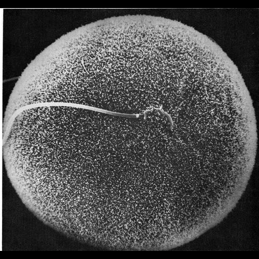  NCBI Organism:Phodopus; Cell Types:oocyte, sperm; Cell Components:microvillus membrane Biological process:single fertilization, membrane fusion involved in acrosome reaction;