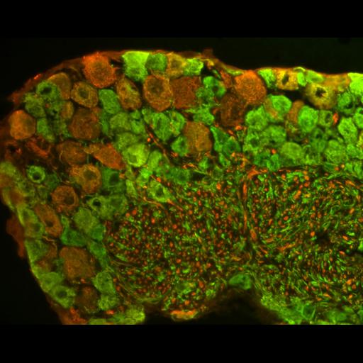  NCBI Organism:Mus musculus; Cell Types:sensory neuron Cell Components:neurofilament Biological process:intermediate filament-based process