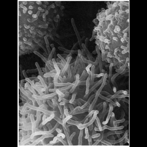  NCBI Organism:Mus musculus; Cell Types:peritoneal macrophage Cell Components:microvillus Biological process:immune system process