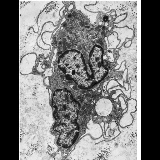  NCBI Organism:Didelphimorphia; Cell Types:macrophage Cell Components:lysosome, nucleus; Biological process:pinocytosis, endocytosis;