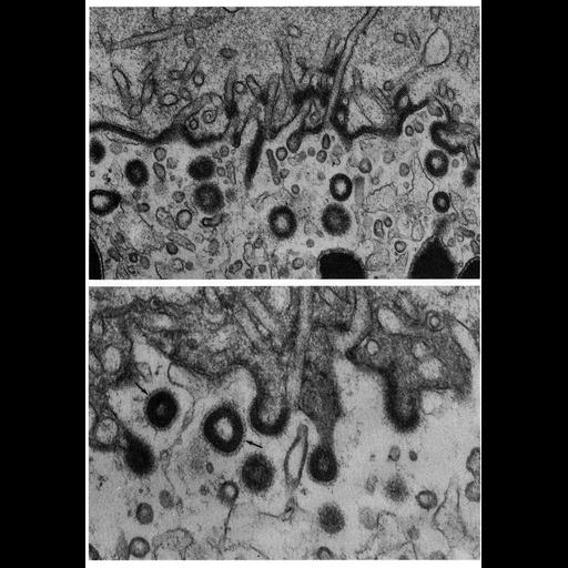  NCBI Organism:Periplaneta americana; Cell Types:oocyte Cell Components:coated vesicle, glycocalyx; Biological process:vitellogenesis, endocytosis;