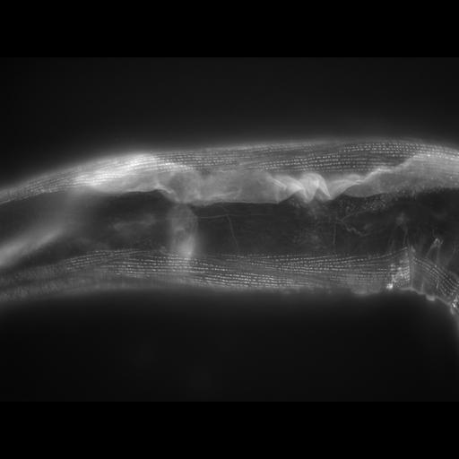  NCBI Organism:Caenorhabditis elegans; Cell Types:muscle cell Cell Components:actin filament Biological process:chronological cell aging