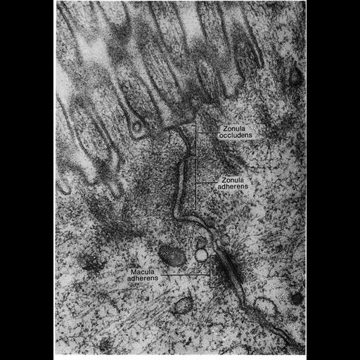  NCBI Organism:Rattus; Cell Types:epithelial cell Cell Components:apical junction complex, zonula adherens, apical part of cell, desmosome; Biological process:maintenance of apical/basal cell polarity