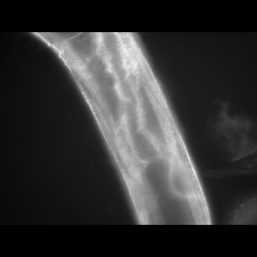  NCBI Organism:Caenorhabditis elegans; Cell Types:muscle cell Cell Components:actin filament Biological process:chronological cell aging