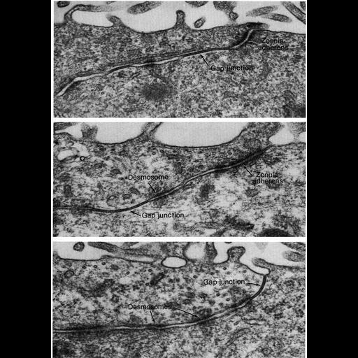  NCBI Organism:Rattus; Cell Types:ependymal cell, epithelial cell; Cell Components:zonula adherens, gap junction, desmosome; Biological process:cell-cell adhesion, cell communication, cell-cell junction organization;