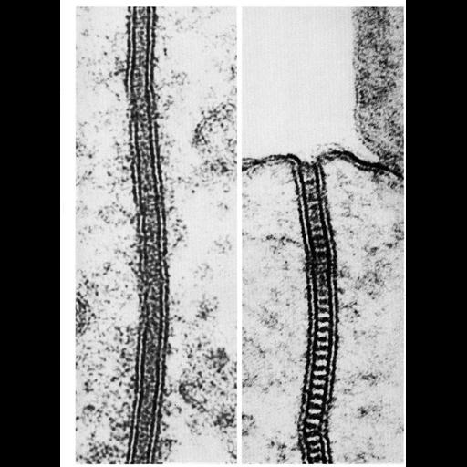  NCBI Organism:Siphonaptera, unclassified Insecta, ; Cell Types:gut absorptive cell, epithelial cell; Cell Components:septate junction, cell-cell junction; Biological process:cell-cell junction organization