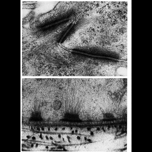  NCBI Organism:Phodopus, Ambystoma, ; Cell Types:squamous epithelial cell Cell Components:desmosome, cell-cell junction, keratin filament, cell-cell junction; Biological process:cell adhesion, cell-cell junction organization;