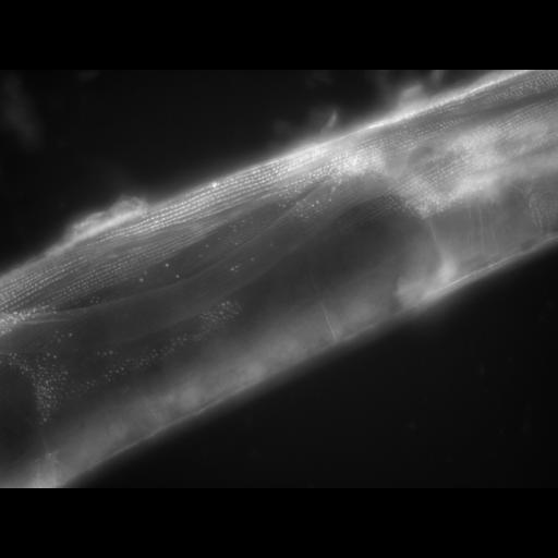  NCBI Organism:Caenorhabditis elegans; Cell Types:muscle cell Cell Components:actin filament Biological process:chronological cell aging