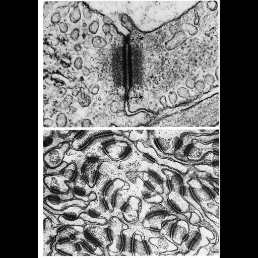  NCBI Organism:Opsanus tau, Bos taurus, ; Cell Types:capillary endothelial cell, epidermal cell, stratified squamous epithelial cell; Cell Components:desmosome, puncta adhaerentia, plasma membrane, cell-cell junction; Biological process:cell adhesion, cell-cell junction organization;