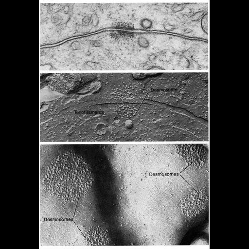  NCBI Organism:Mus musculus; Cell Types:non-pigmented ciliary epithelial cell, epidermal cell; Cell Components:desmosome, intermediate filament, keratin filament, plasma membrane; Biological process:cell adhesion, cell-cell junction organization;