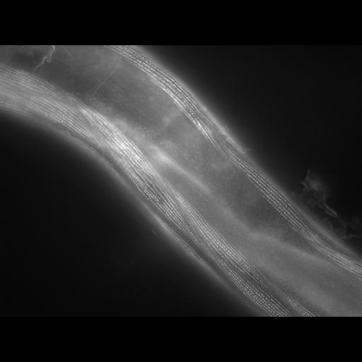  NCBI Organism:Caenorhabditis elegans; Cell Types:muscle cell Cell Components:actin filament Biological process:chronological cell aging