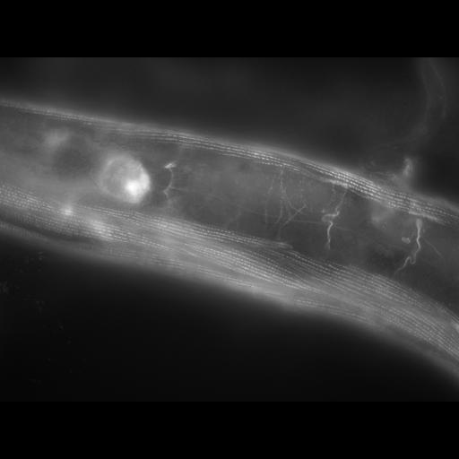  NCBI Organism:Caenorhabditis elegans; Cell Types:muscle cell Cell Components:actin filament Biological process:chronological cell aging