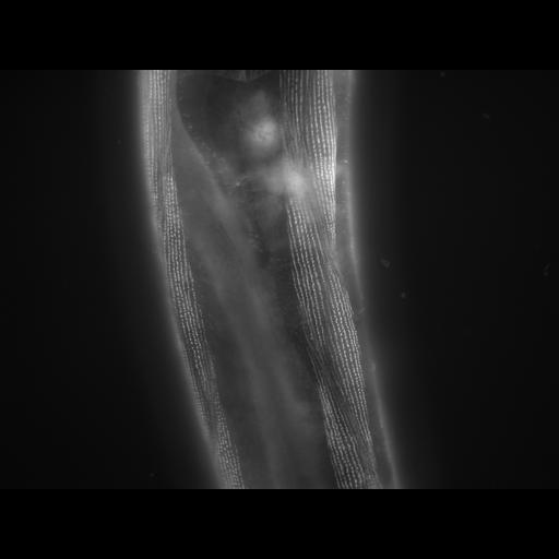  NCBI Organism:Caenorhabditis elegans; Cell Types:muscle cell Cell Components:actin filament Biological process:chronological cell aging