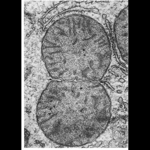  NCBI Organism:Rattus; Cell Types:hepatocyte Cell Components:mitochondrion, mitochondrial crista, mitochondrial outer membrane, mitochondrial inner membrane; Biological process:mitochondrial fission