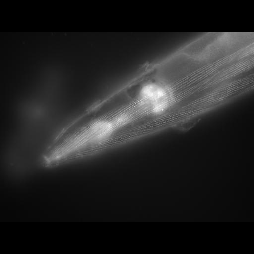  NCBI Organism:Caenorhabditis elegans; Cell Types:muscle cell Cell Components:actin filament Biological process:chronological cell aging