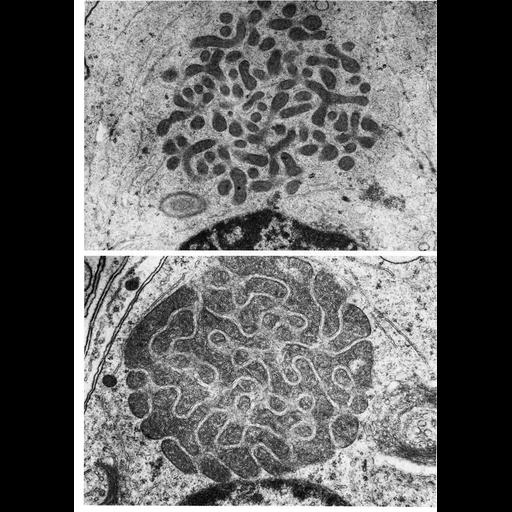  NCBI Organism:unclassified Insecta; Cell Types:spermatid Cell Components:mitochondrion, mitochondrial outer membrane, mitochondrial inner membrane, Nebenkern;