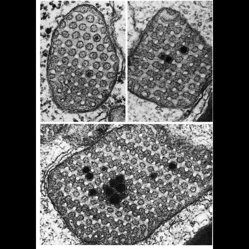  NCBI Organism:Xenopus; Cell Types:Sertoli cell Cell Components:mitochondrion, mitochondrial crista, mitochondrial outer membrane, mitochondrial inner membrane; Biological process:cellular respiration