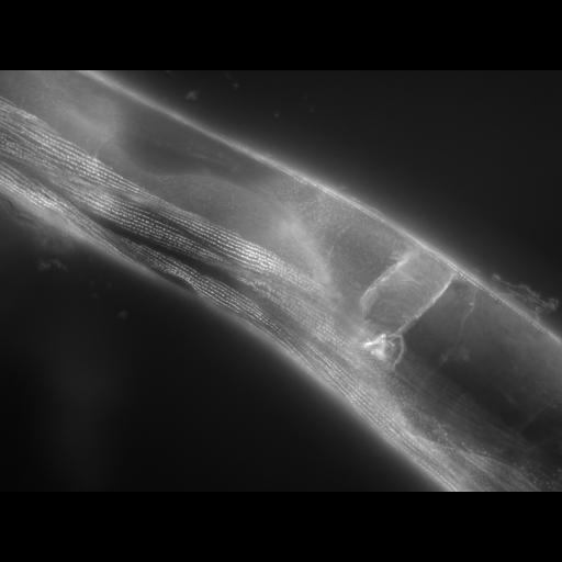  NCBI Organism:Caenorhabditis elegans; Cell Types:muscle cell Cell Components:actin filament Biological process:chronological cell aging