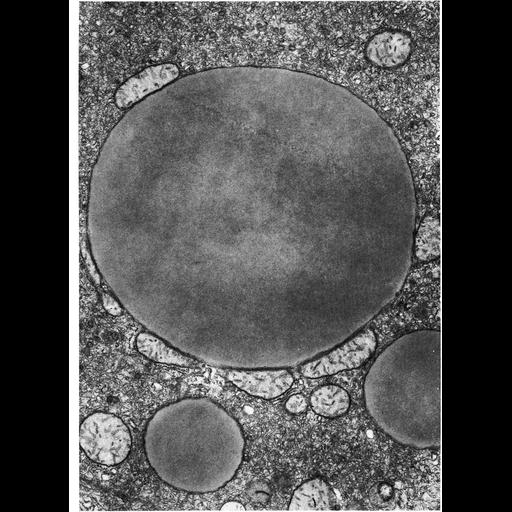  NCBI Organism:Phodopus; Cell Types:hepatocyte Cell Components:mitochondrion, lipid particle; Biological process:cellular respiration