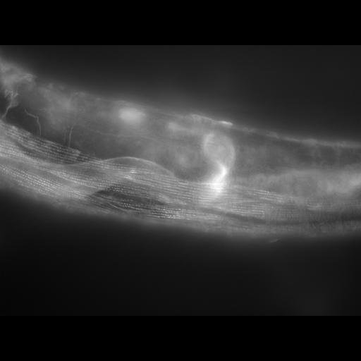  NCBI Organism:Caenorhabditis elegans; Cell Types:muscle cell Cell Components:actin filament Biological process:chronological cell aging