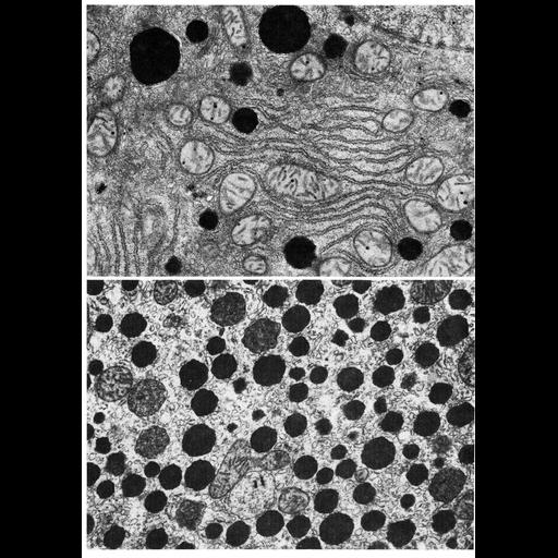  NCBI Organism:Rattus; Cell Types:hepatocyte Cell Components:peroxisome, cytoplasm, organelle; Biological process:cellular catabolic process, cholesterol metabolic process;