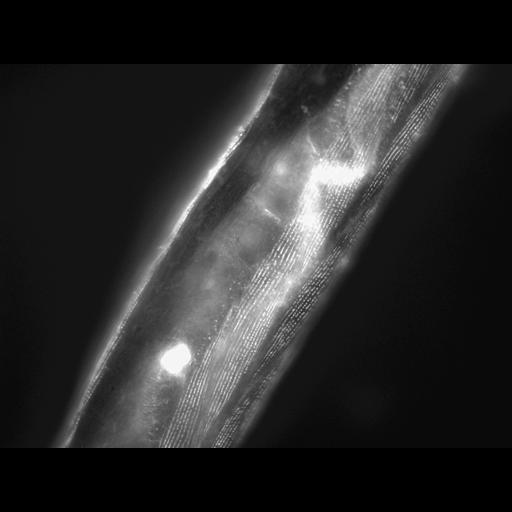  NCBI Organism:Caenorhabditis elegans; Cell Types:muscle cell Cell Components:actin filament Biological process:chronological cell aging