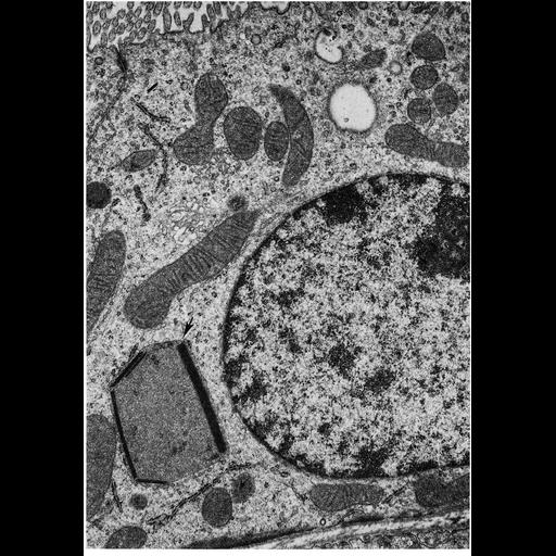  NCBI Organism:Rattus; Cell Types:renal principal cell Cell Components:peroxisome, cytoplasm, organelle; Biological process:cellular catabolic process