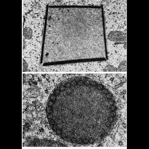  NCBI Organism:Rattus; Cell Types:renal principal cell Cell Components:peroxisome, cytoplasm, organelle; Biological process:cellular catabolic process