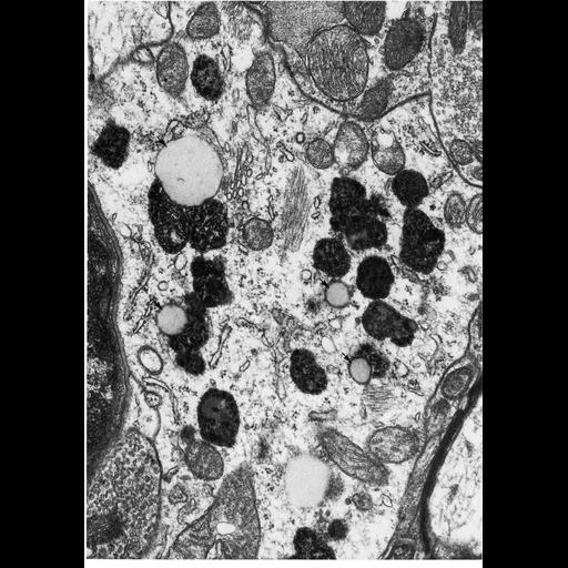  NCBI Organism:Rattus; Cell Types:neuron Cell Components:pigment granule Biological process:aging