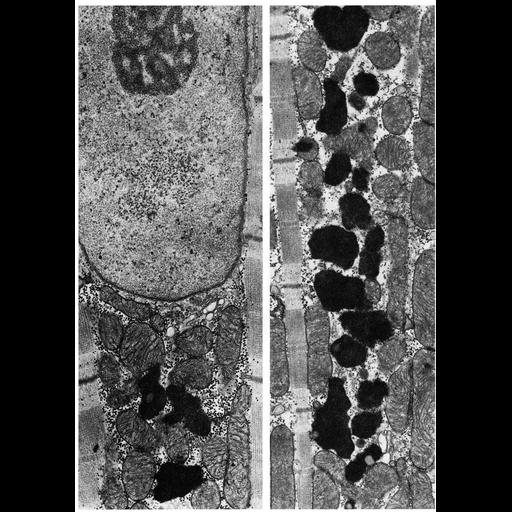  NCBI Organism:Felis catus; Cell Types:cardiac muscle cell Cell Components:pigment granule, sarcoplasm, mitochondrion; Biological process:aging