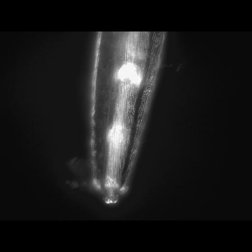  NCBI Organism:Caenorhabditis elegans; Cell Types:muscle cell Cell Components:actin filament Biological process:chronological cell aging