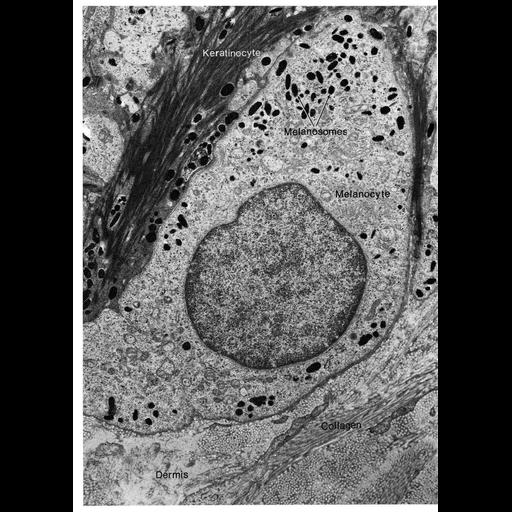  NCBI Organism:Homo sapiens; Cell Types:melanocyte Cell Components:melanosome, keratin filament, collagen; Biological process:pigmentation