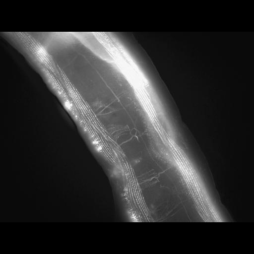  NCBI Organism:Caenorhabditis elegans; Cell Types:muscle cell Cell Components:actin filament Biological process:chronological cell aging